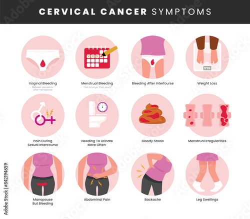 Cervical cancer symptoms infographic medical poster design, labeled National Ovarian Cancer Awareness Month, Polycystic Ovary Syndrome. Female Reproductive System With Ovarian Cysts sexual prevention.