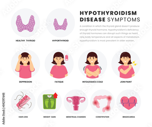 Hypothyroidism symptoms infographic medical poster design, labeled Thyroid gland problem with endocrinology system, hormone production, overactive thyroid gland disease with woman character. photo