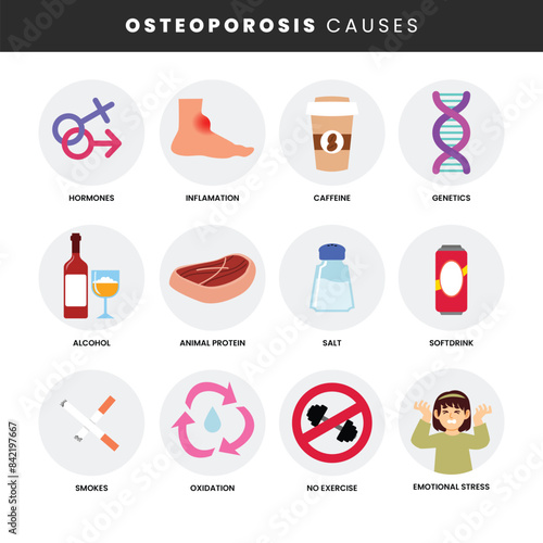 Osteoporosis symptoms infographic medical poster design, labeled rheumatoid osteoarthritis anatomical prevent of bone loss of human. Causes of osteopathy, Osteoporosis causes, spine joint bones.