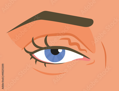 Tired Eye Twitching with Health problems Vector Illustration. Person suffering from blepharospasm showing symptoms 
