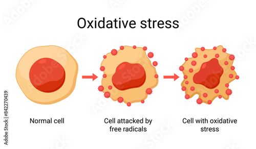 Oxidative stress vector design illustration photo