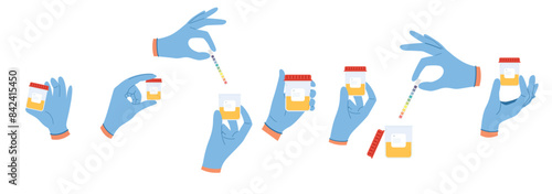 Set of illustrations with urine analysis. Doctor hands in blue gloves hold containers with pee sample