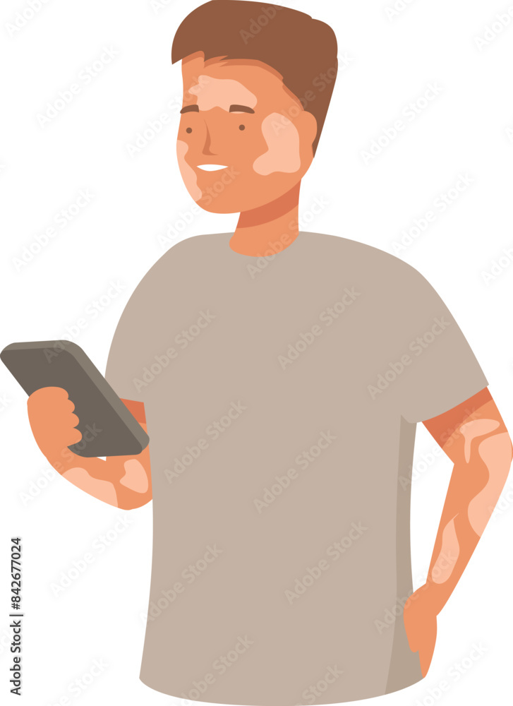 Young man with vitiligo holding smartphone, checking social media, using mobile app, browsing internet Young man with vitiligo holding smartphone, checking social media, using mobile app, browsing internet
