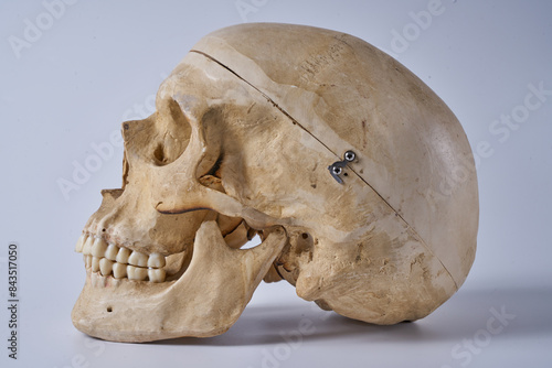 Adult male skull on a white background.