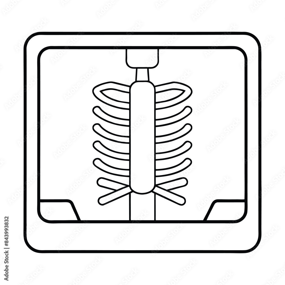 Detailed vector illustration of a ribcage X-ray with clear bone structure Detailed vector illustration of a ribcage X-ray with clear bone structure