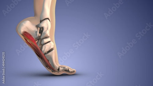 Medical animation of plantar fascia dysfunction