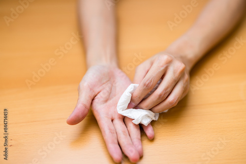 Woman suffer from hand perspiration clean up with tissue photo