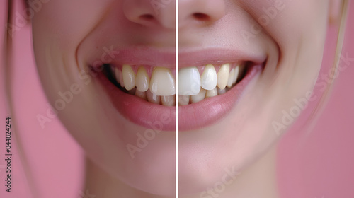 close up of smile with yellow and white teeth