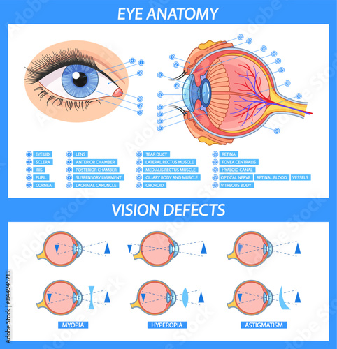 Comprehensive Vector Infographic Showing Eye Anatomy With Labeled Parts And Common Vision Defects. Visual Guide