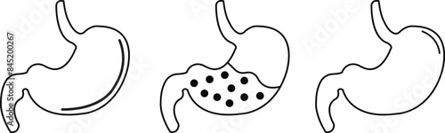 Set of Digestive system anatomy. Black colors Stomach gastric icons. Human internal organs symbols. Stomach oncology procedure signs in line styles editable stock isolated on transparent background.