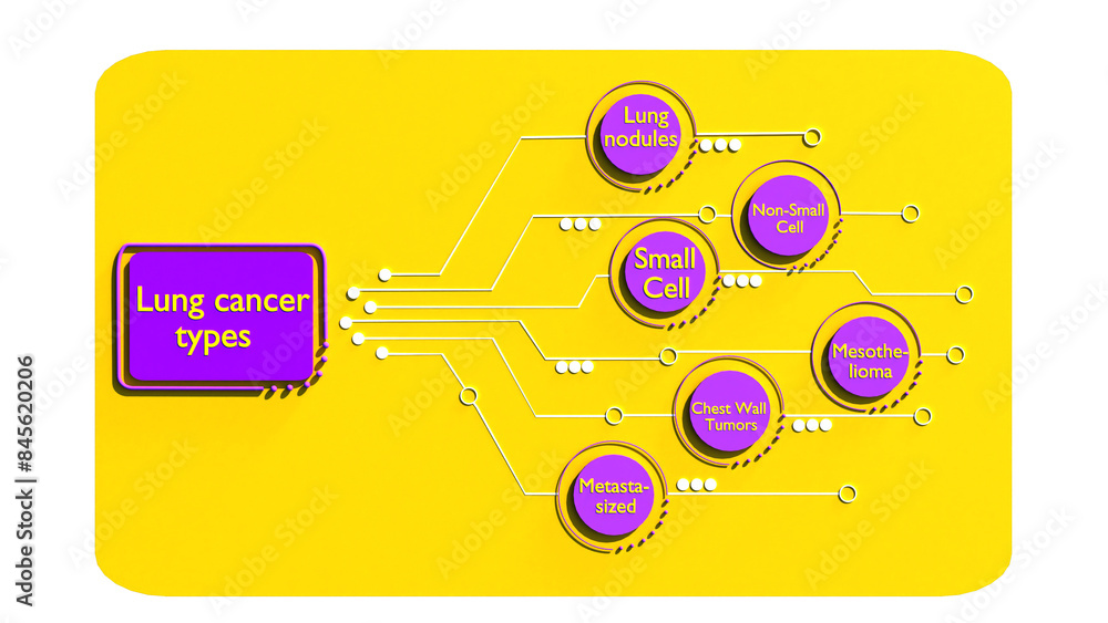 3D Cancer Cell Infographic, Lung Cancer Cells types in 3D style, Tumor ...