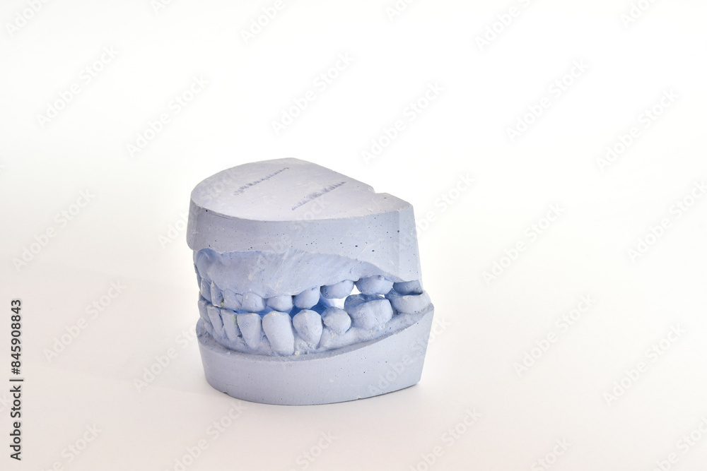 Dental impression of teeth Dental impression of teeth