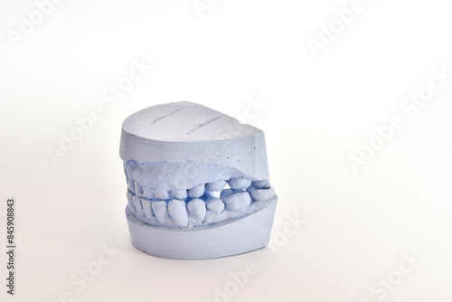 Dental impression of teeth