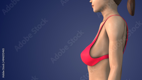 Mastopexy also known as a breast lift photo