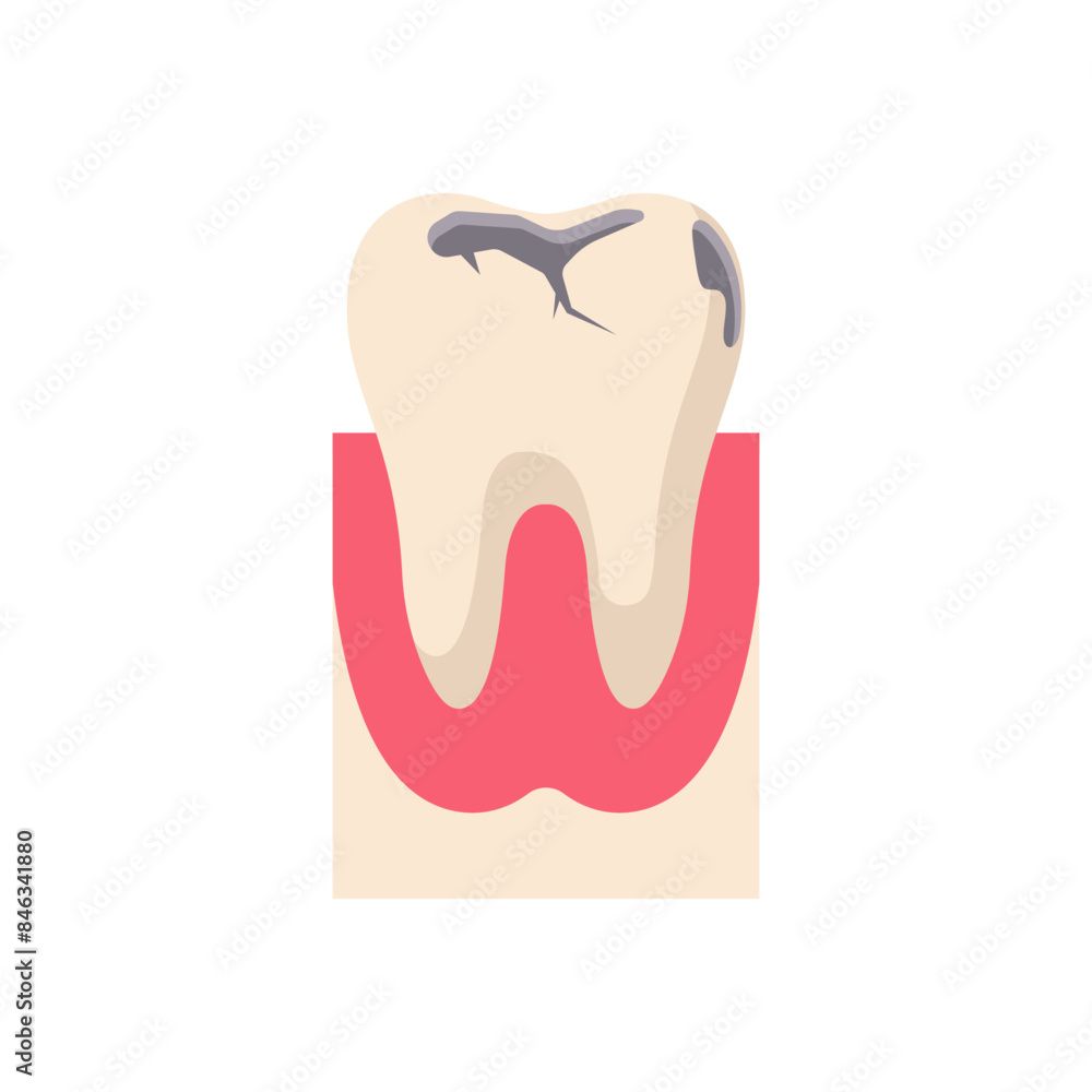 Healthy and sick teeth in the mouth on the gum. Dirty and clean. Two teeth cartoon characters icons. Healthy white teeth and with a hole. Vector illustration flat design. Isolated on white background. Healthy and sick teeth in the mouth on the gum. Dirty and clean. Two teeth cartoon characters icons. Healthy white teeth and with a hole. Vector illustration flat design. Isolated on white background.