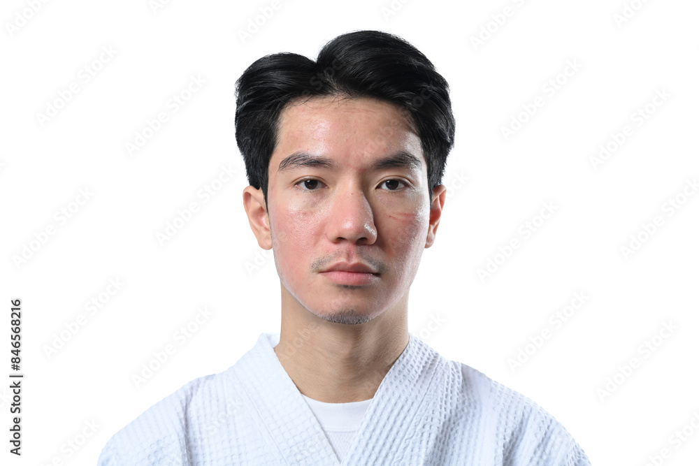 Man after facial laser treatment on white background. Aesthetic face treatment concept