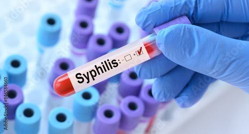 Foto Doctor holding a test blood sample tube with Syphilis test on the background of medical test tubes with analyzes