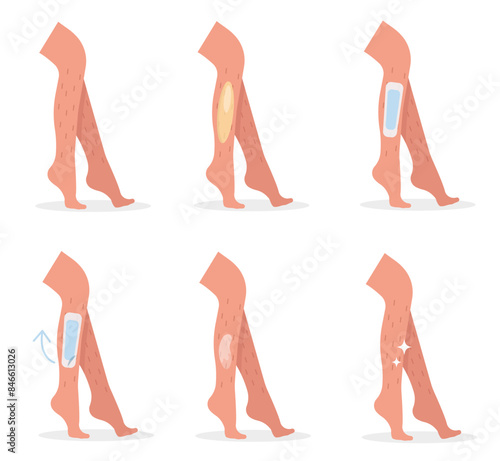 Leg depilation. Waxing leg instruction. Hair removal. Bare human feet. Healthy skin, nails, body. Foot care and cosmetic treatment. Vector illustration