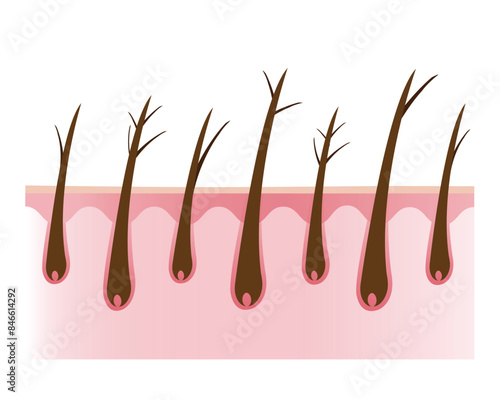 The cross section of damaged and types of split ends hair with scalp layer vector illustration isolated on white background. Dryness, baby split, y split and tree. Hair care and problem concept.
