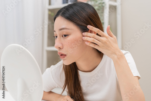 Dermatology, expression face worry asian young woman looking mirror hand touch face at dark spot of melasma, freckle from pigment melanin, allergy sun. Beauty care, skin problem treatment, acne care.