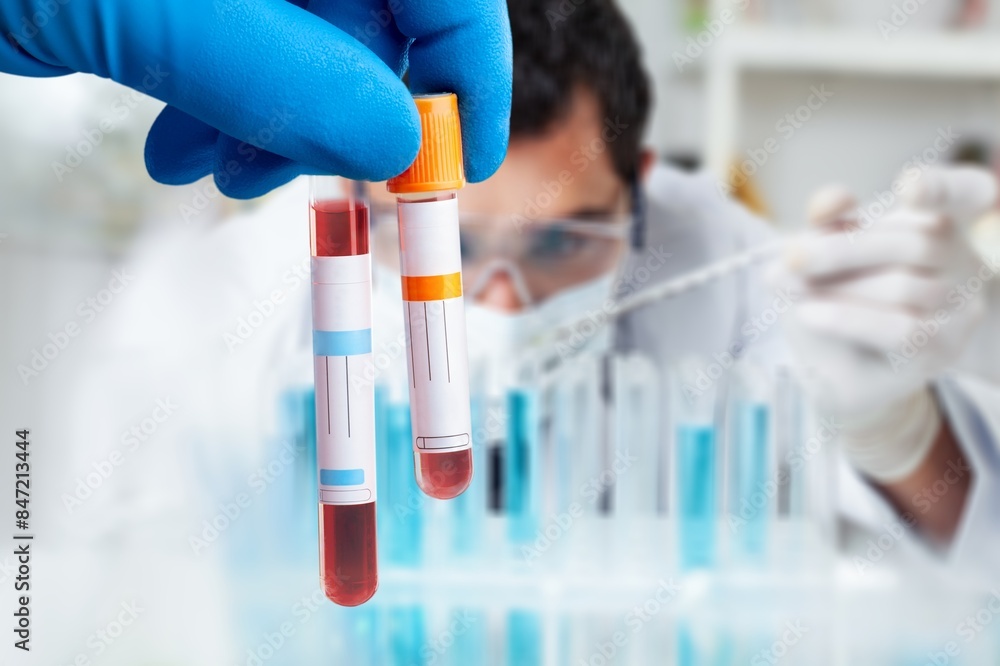 Doctor holding blood sample in test tube Doctor holding blood sample in test tube