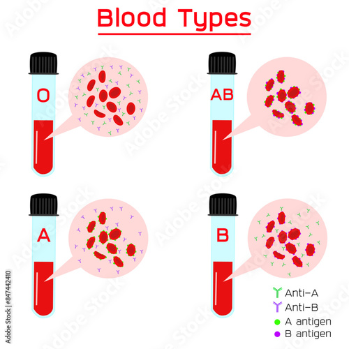ABO Blood groups. four basic blood types, type A and type B antigens. Medical and healthcare infographic.