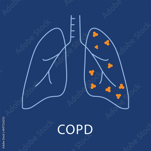 Detailed COPD Icon - Medical Condition, Health, Respiratory Vector with editable stroke.