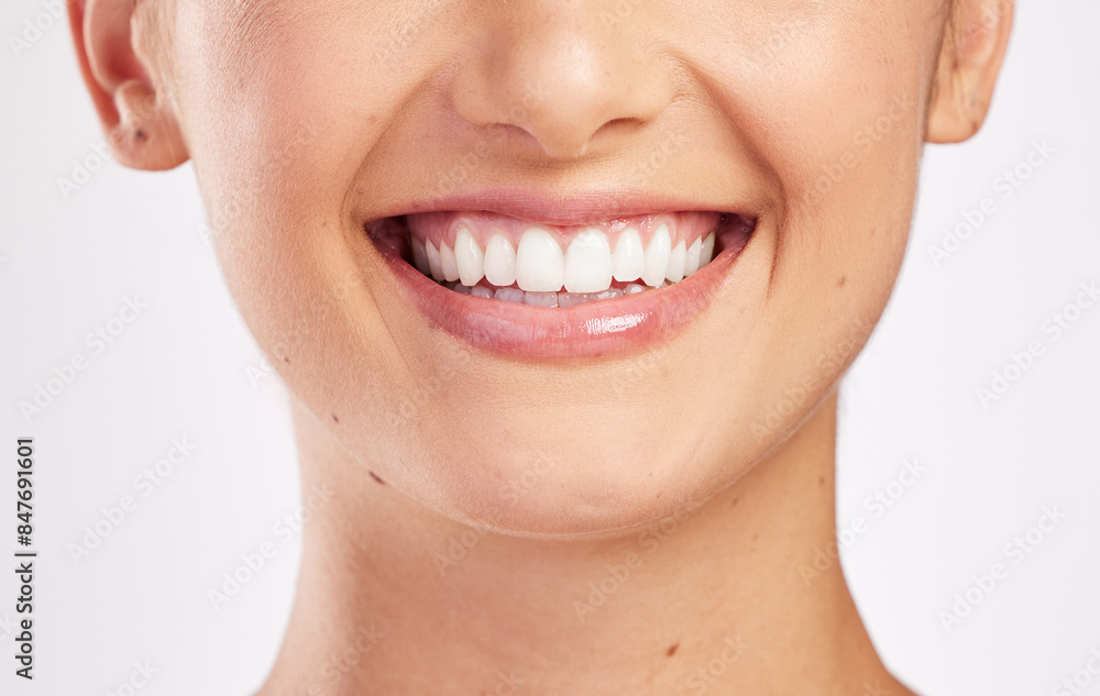 Obraz premium Woman, mouth and teeth in studio for oral health, dental care and orthodontics isolated on white background. Female person, smile and tooth whitening or hygiene, veneers and self care for wellness