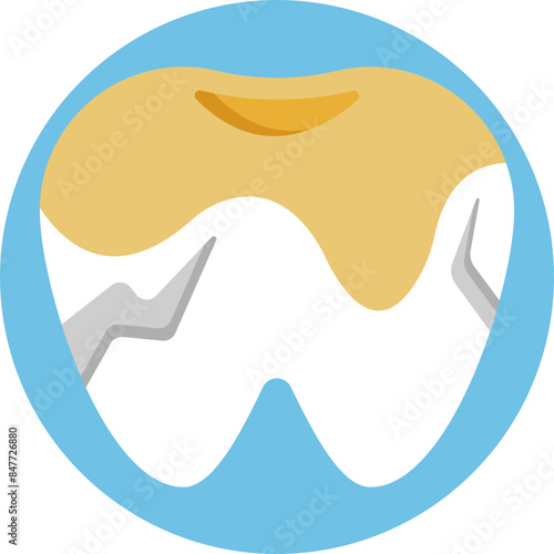 An emblematic representation of the detrimental impact of smoking, this icon portrays a rotten tooth, signaling the risk of tooth decay and dental problems associated with tobacco use.
