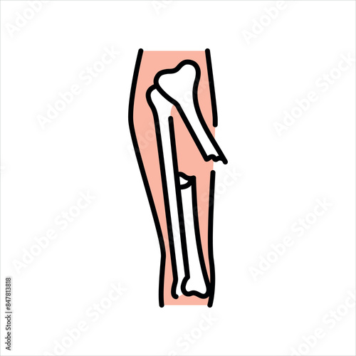 Bone fractures line color icon. Household injuries sign for web page