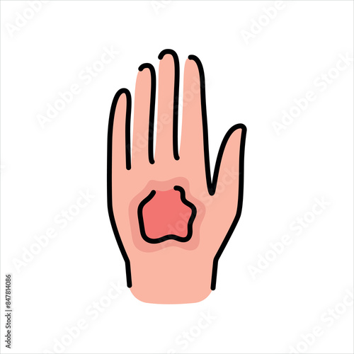 Scald line color icon. Household injuries sign for web page