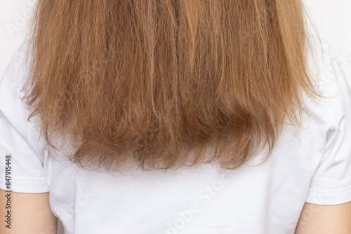 Tableau sur toile Back view of a woman with damaged dry hair and split ends, isolated on a white background