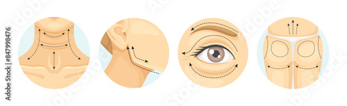 Plastic Surgery as Restoration and Reconstruction of Human Body Part in Circle Vector Set