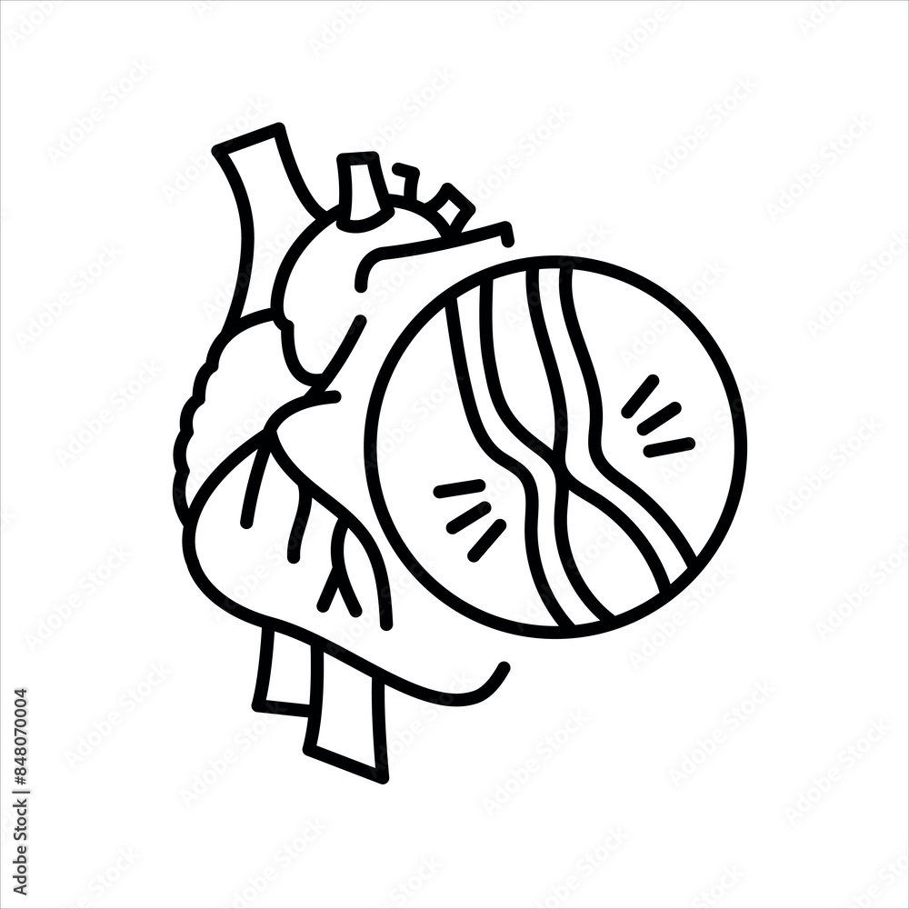 Myocardiopathy line black icon. Sign for web page Myocardiopathy line black icon. Sign for web page