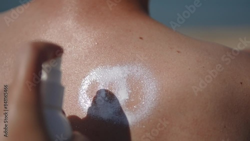 Sunscreen lotion being applied from bottle to man back close up. Spraying white UV protection cream onto tourist tanned skin at sea cost. Moisturizing cream after sunbathing leaves marks on body.