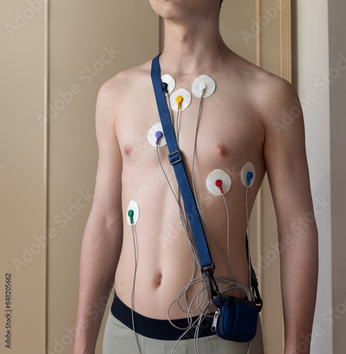 Young man wearing holter, 24 hrs electrocardiogram monitor device on his chest