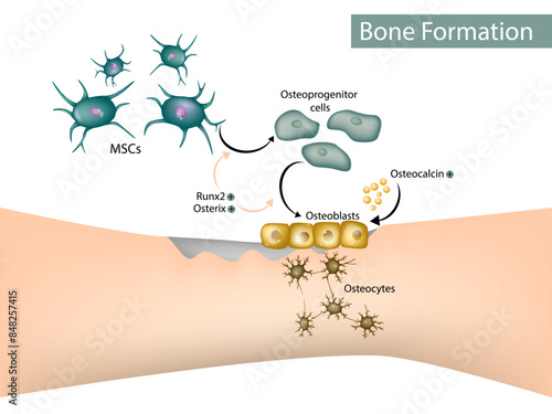Bone Formation. Osteoblast,  Osteocytes, Mesenchymal Stem Cells
