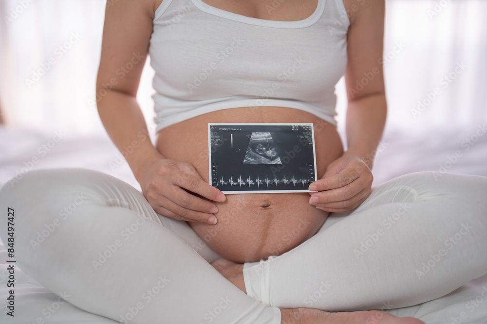 A portrait of happy Asian pregnant woman in bedroom at home with baby ultrasound. Having a baby. Family people lifestyle. Mom love. A portrait of happy Asian pregnant woman in bedroom at home with baby ultrasound. Having a baby. Family people lifestyle. Mom love.