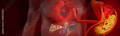 Canvas Print Hyperlipidemia or arteriosclerosis