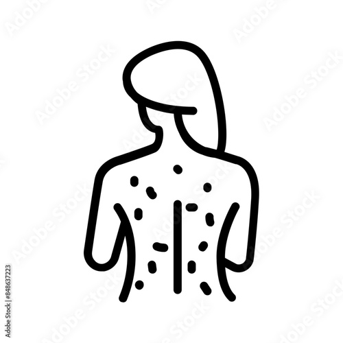 Vector black line icon for Rashes