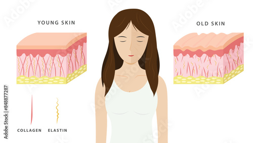 Aging process. comparison of young and aged skin. collagen, elastin and fibroblasts in younger and older skin. flat vector 2d illustration. Concept skin care cosmetics solution.