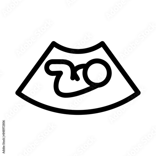 Fetal Ultrasound