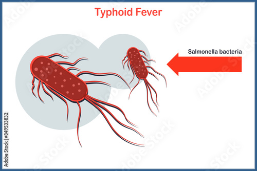 Medical vector illustration in flat style of Salmonella bacteria which causes typhoid fever.
