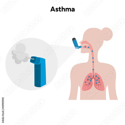 Human take inhaler from asthma zoom inhaler