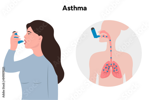 Asthma woman and inhaled with medical diagram