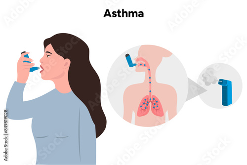 Asthma woman and inhaled with medical infographic
