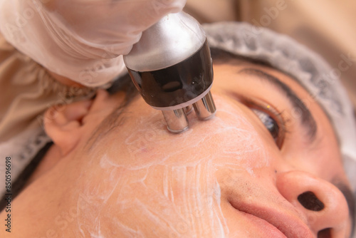 Φωτογραφία Example of radio frequency facial done on a male patient