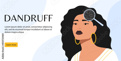 Womens dandruff problem on the head banner. Hair scalp problem. Fungal skin diseases, dermatology.