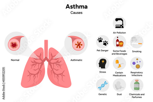 Asthmatic airways disease and main causes
