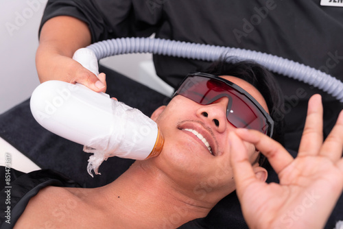 A male patient makes ok sign, looking satisfied while undergoing Diode ICE laser facial hair removal procedure at an aesthetic clinic. photo